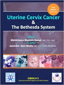 Uterine Cervix Cancer The Bethesda System: CMAS # 3