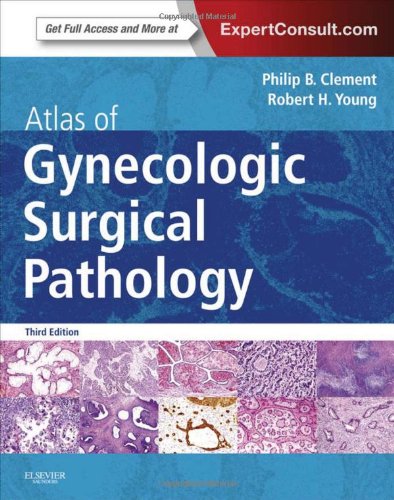 Atlas of Gynecologic Surgical Pathology, 3e