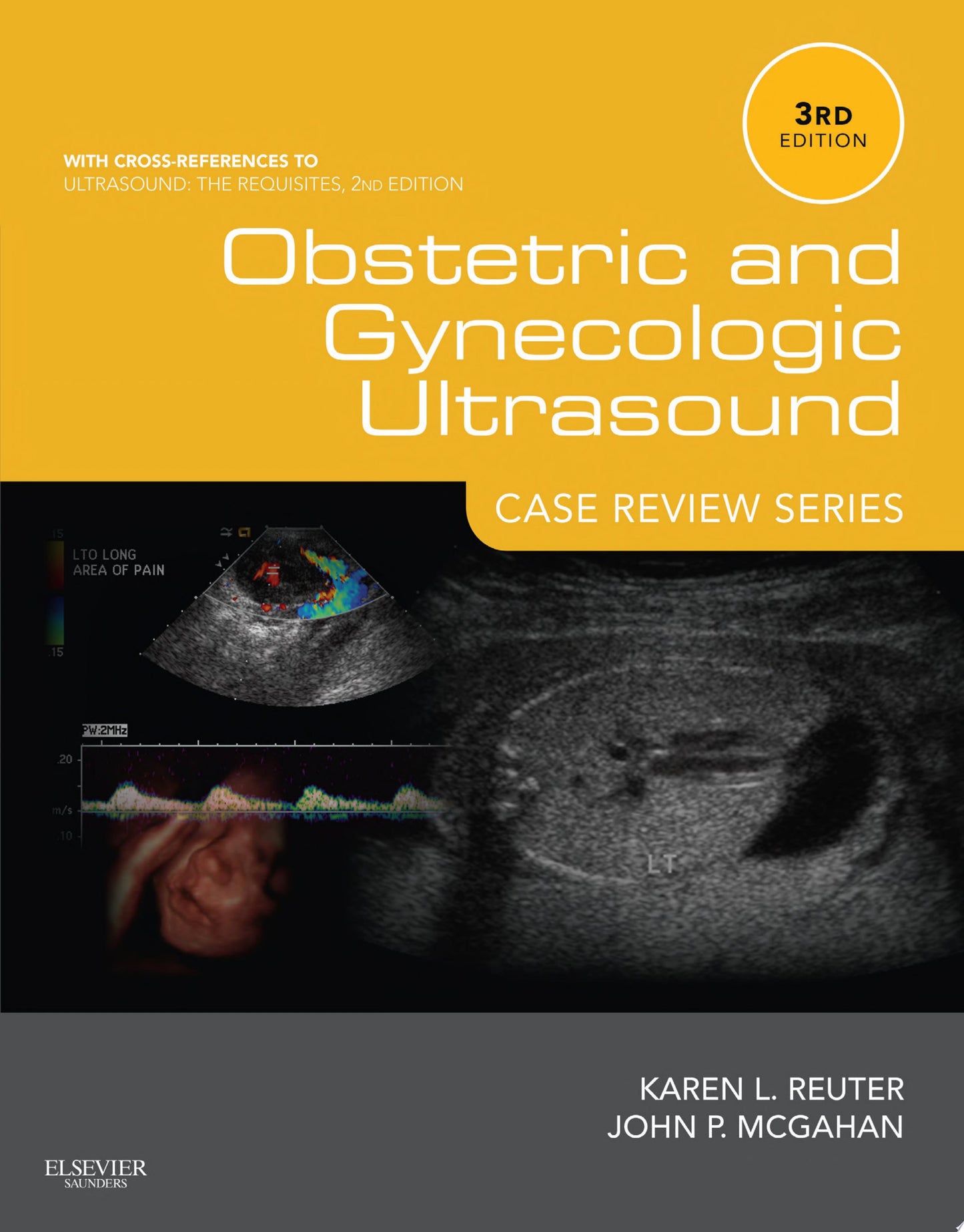 Obstetric and Gynecologic Ultrasound: Case Review Series, 3rd Edition