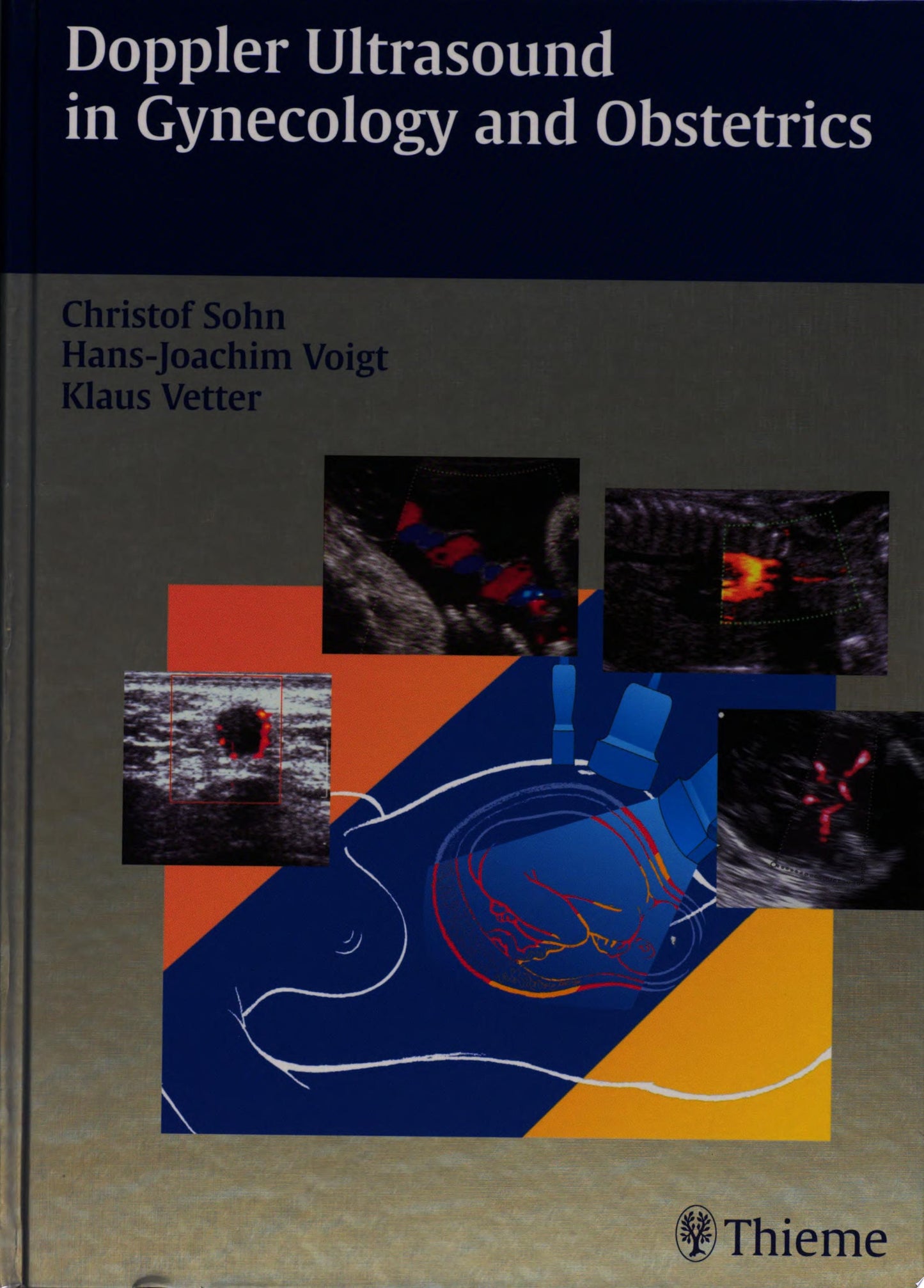 Doppler Ultrasound in Gynecology and Obstetrics