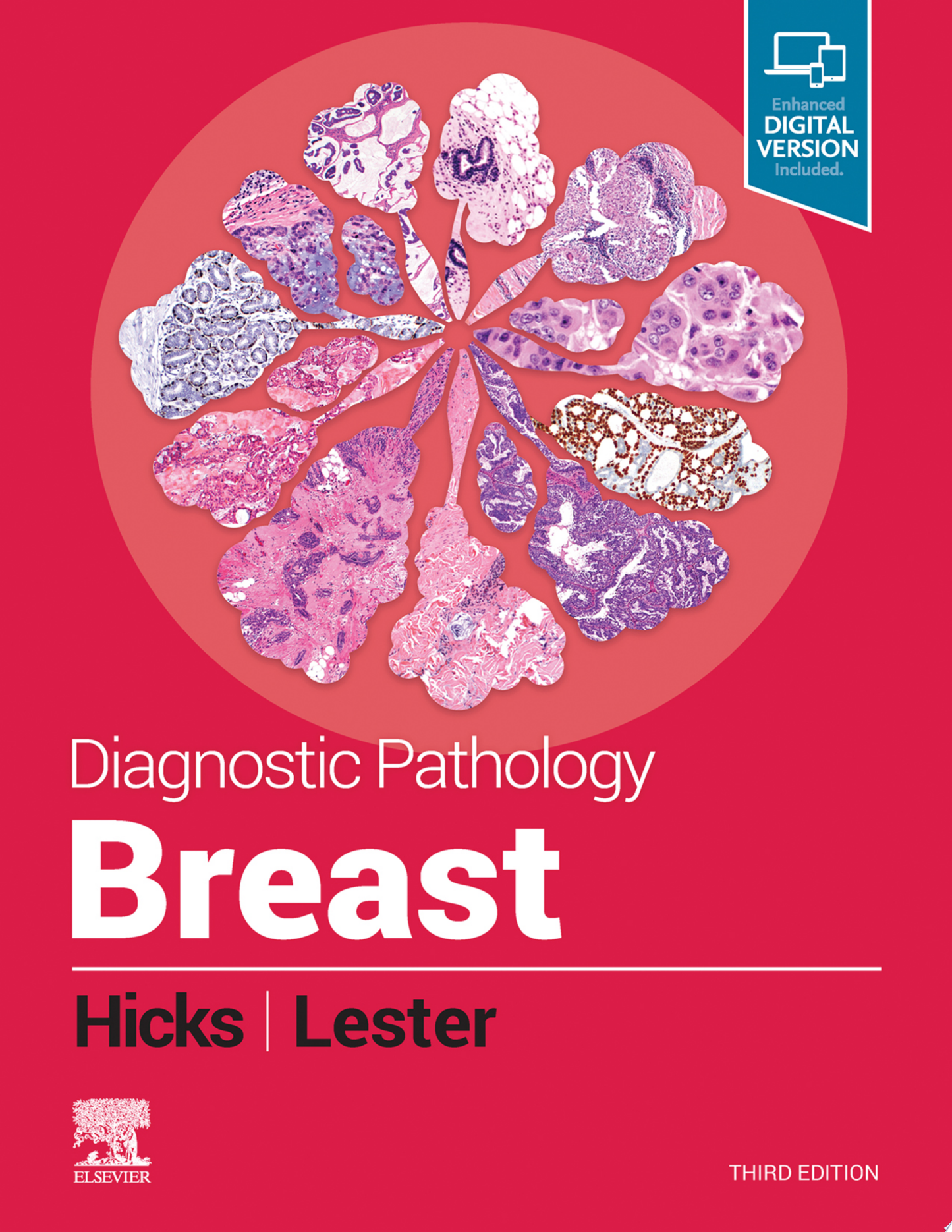 Diagnostic Pathology: Breast, 3rd Edition