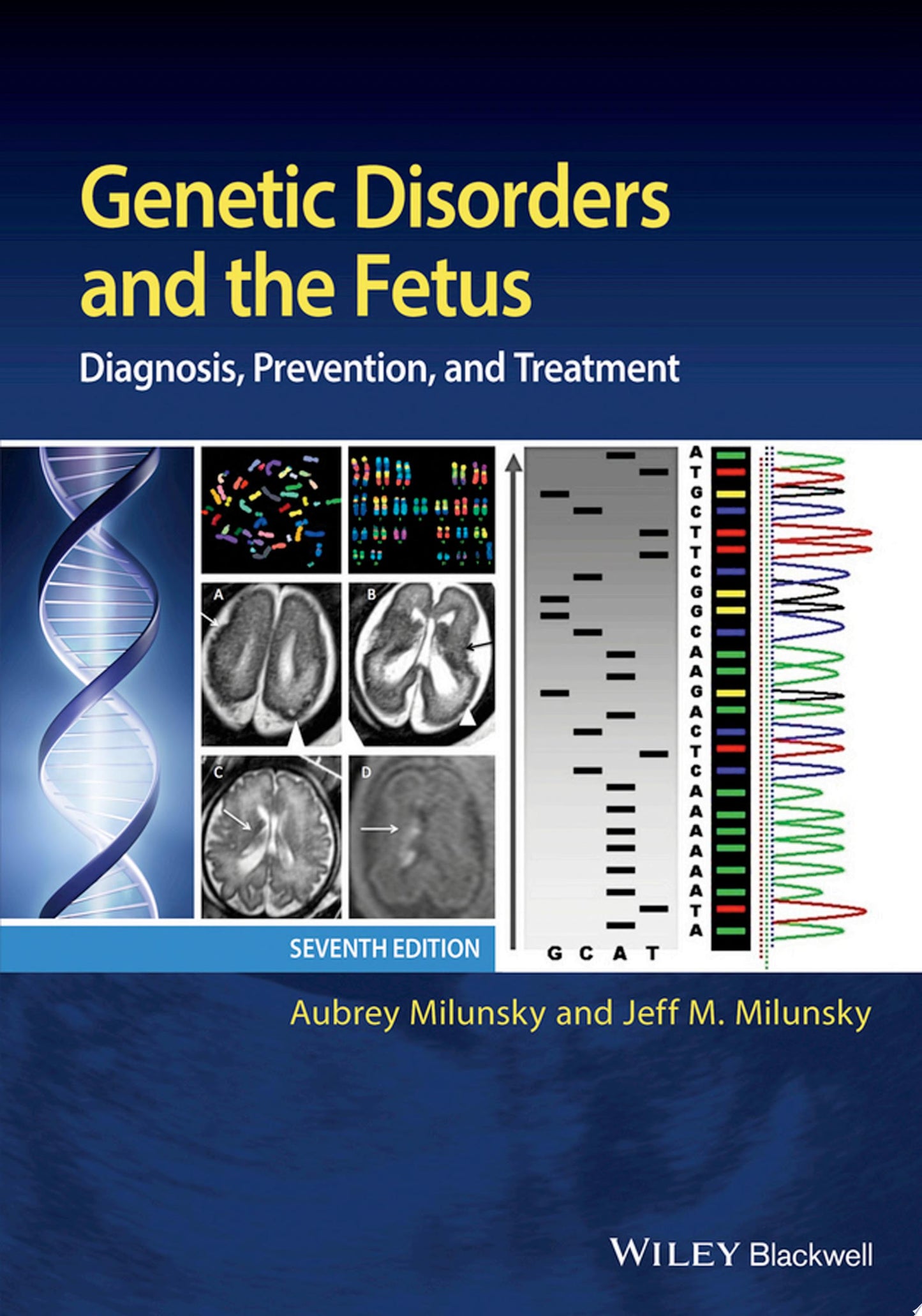 Genetic Disorders and the Fetus: Diagnosis, Prevention and Treatment, 7th Edition
