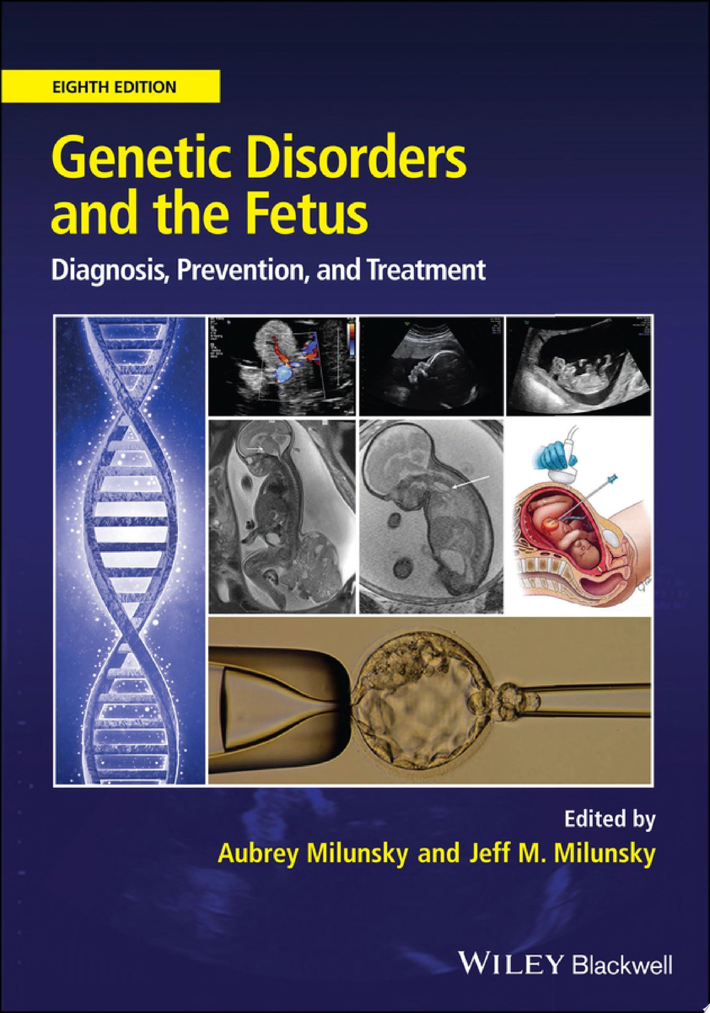 Genetic Disorders and the Fetus: Diagnosis, Prevention and Treatment, 8th Edition