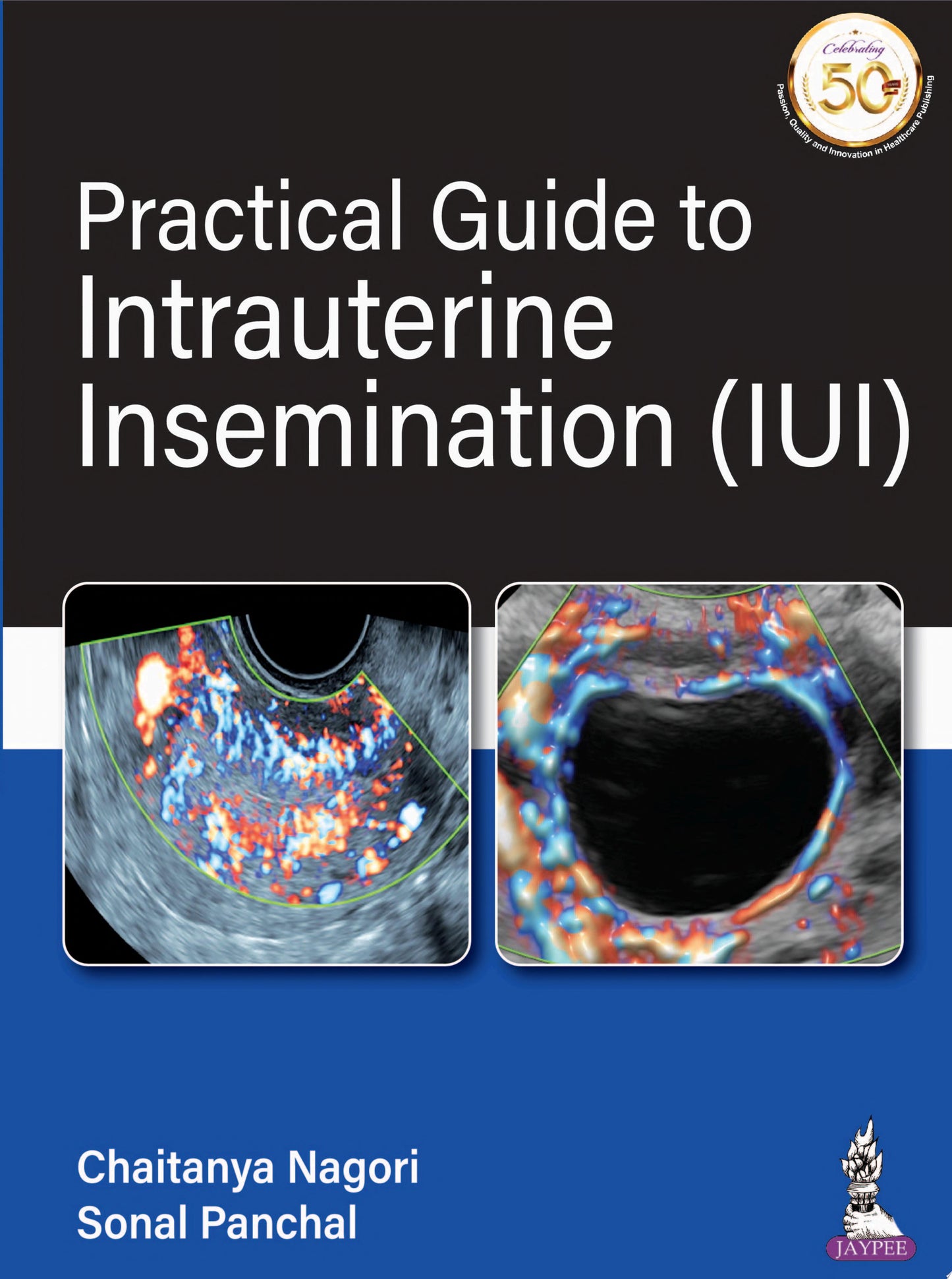 Practical Guide To Intrauterine Insemination