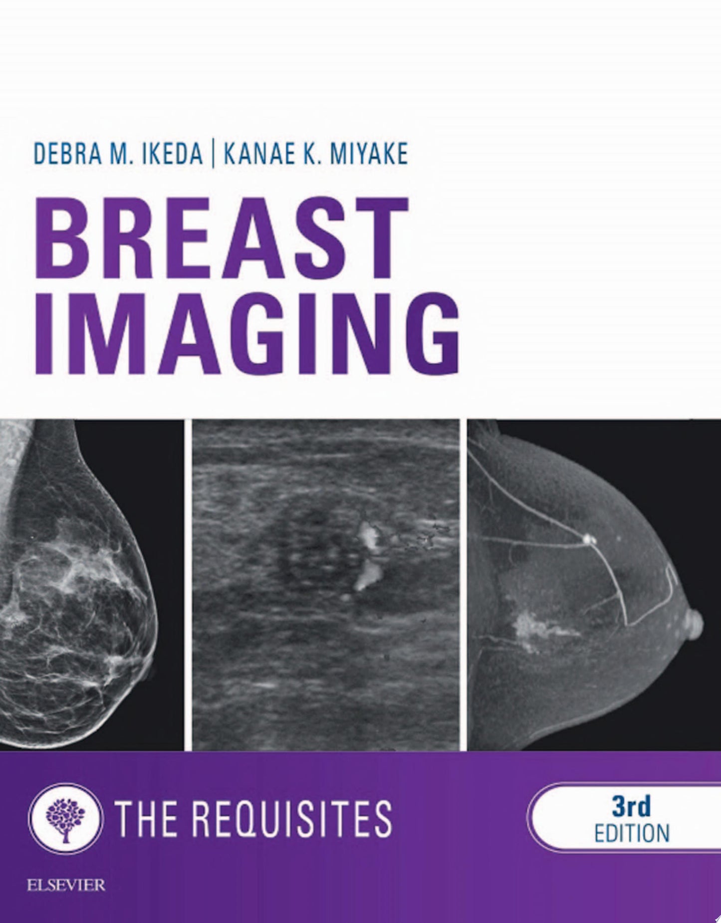 Breast Imaging: The Requisites, 3rd Edition