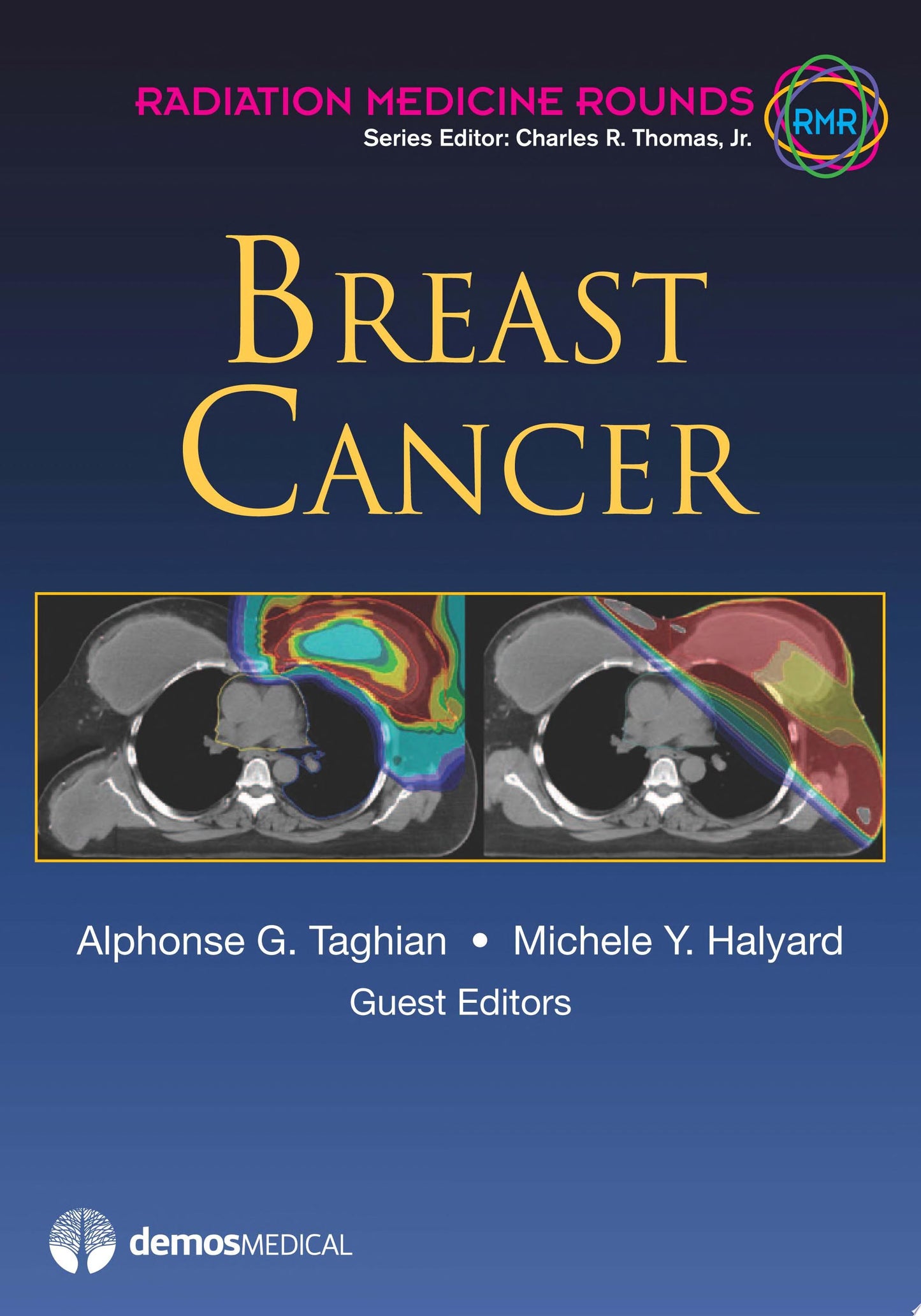 Breast Cancer: A Multidisciplinary Approach