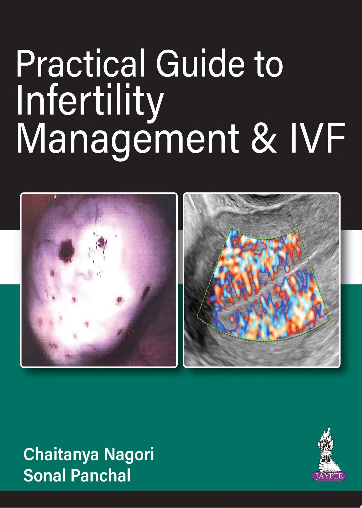 Practical Guide to Infertility Management & IVF