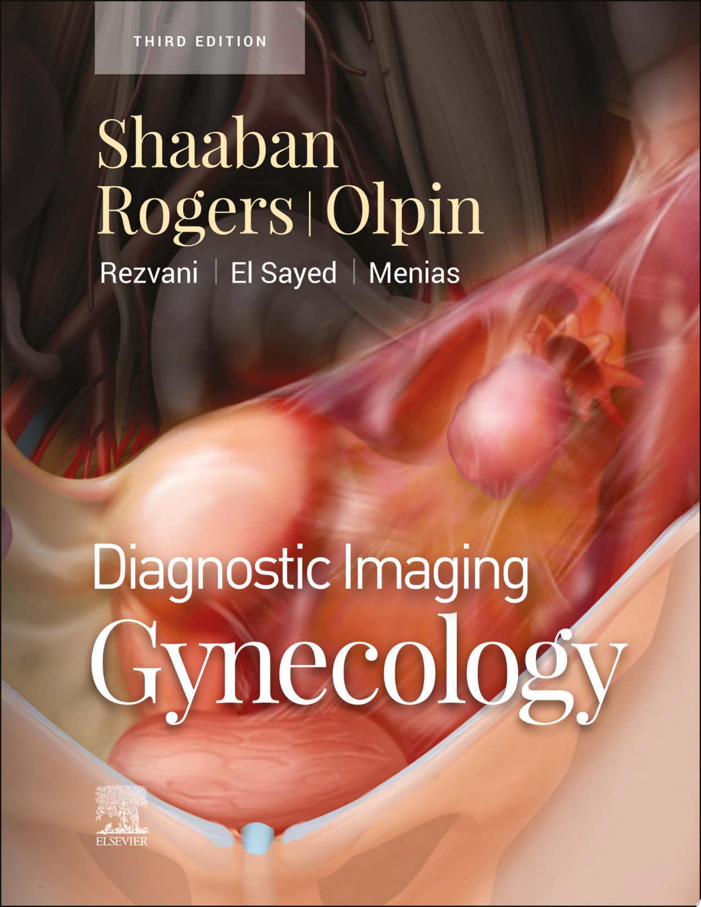 Diagnostic Imaging: Gynecology, 2e