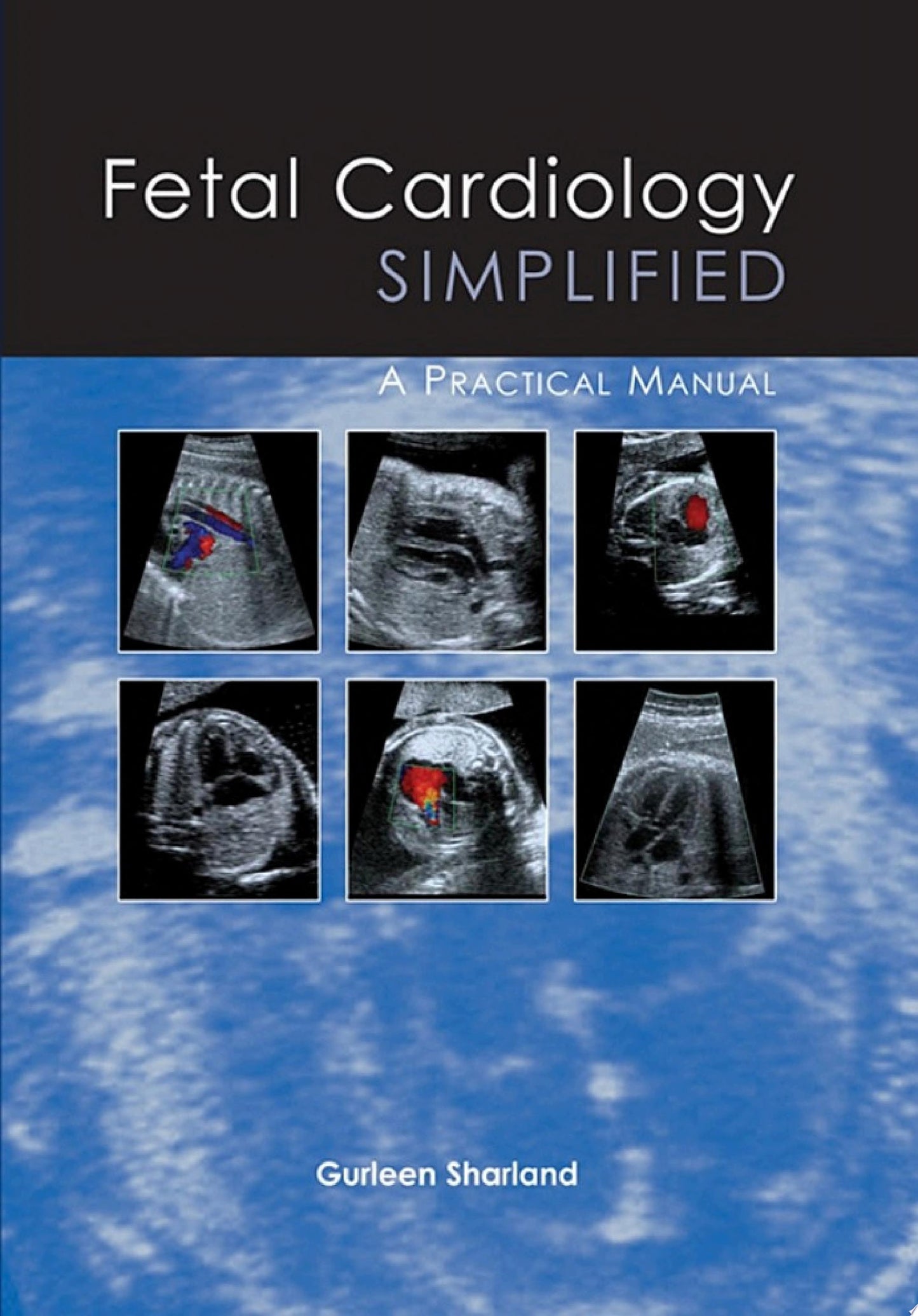 Fetal Cardiology Simplified: A Practical Manual