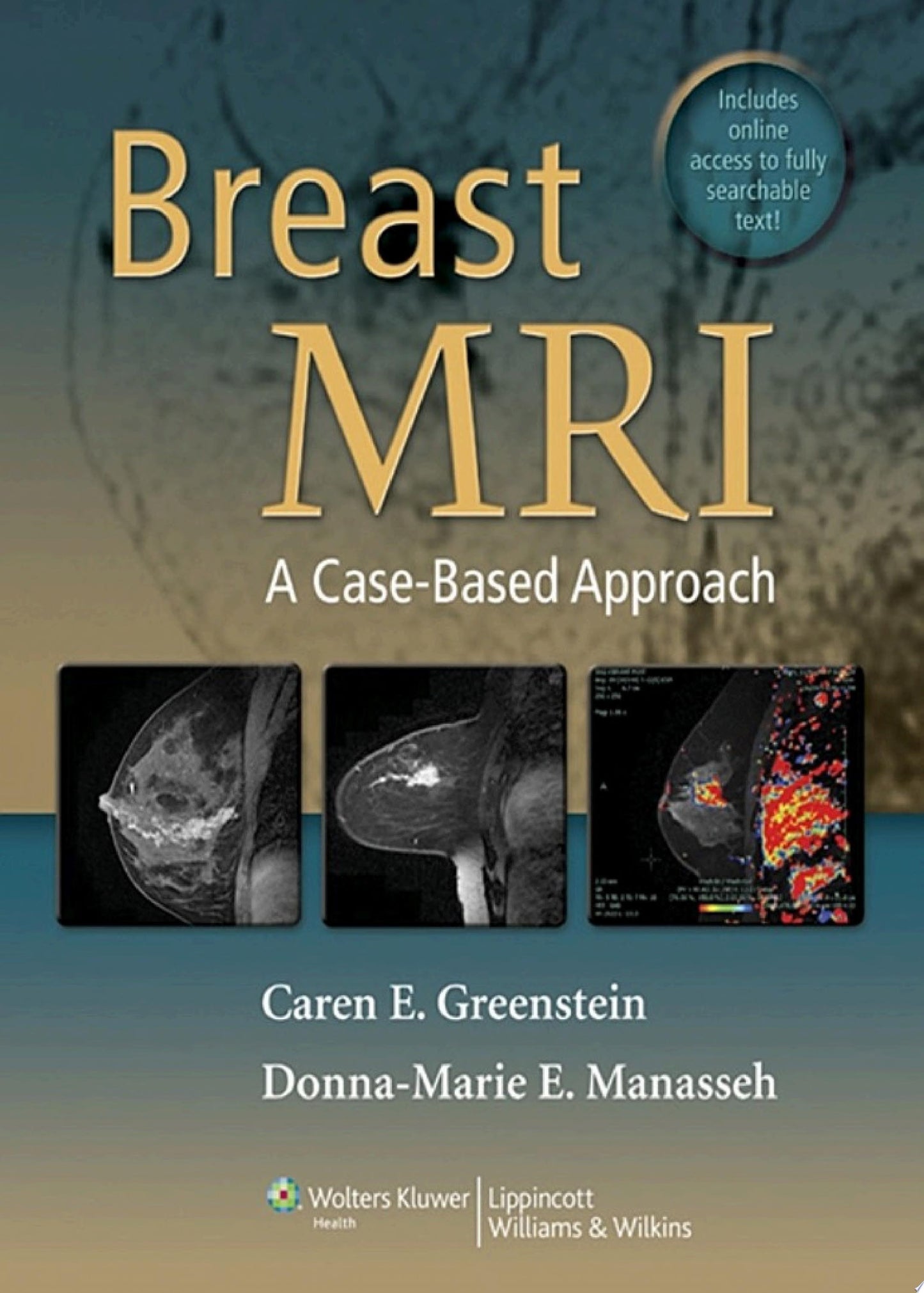Breast MRI: A Case-Based Approach