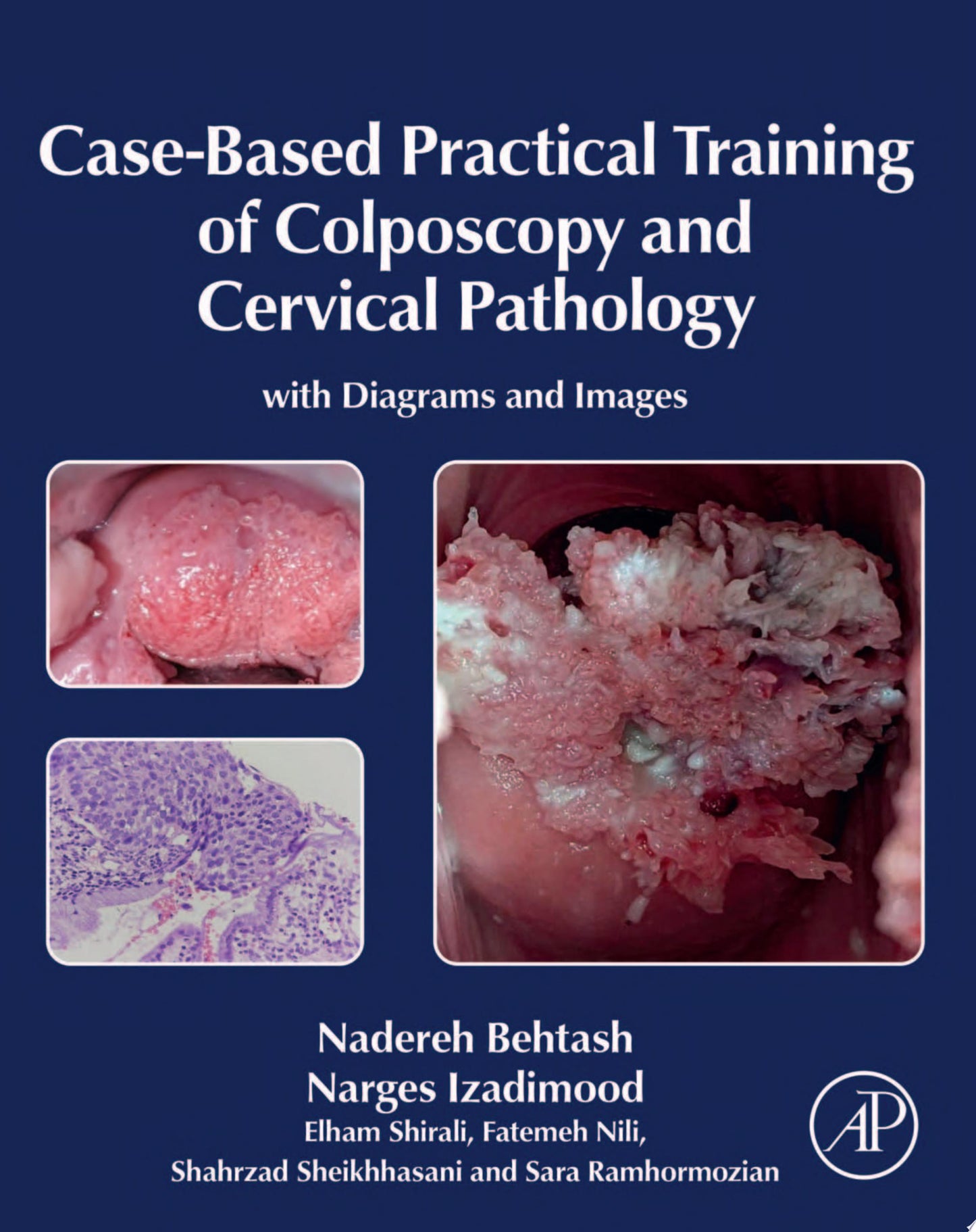 Case-Based Practical Training of Colposcopy and Cervical Pathology: With Diagrams and Images
