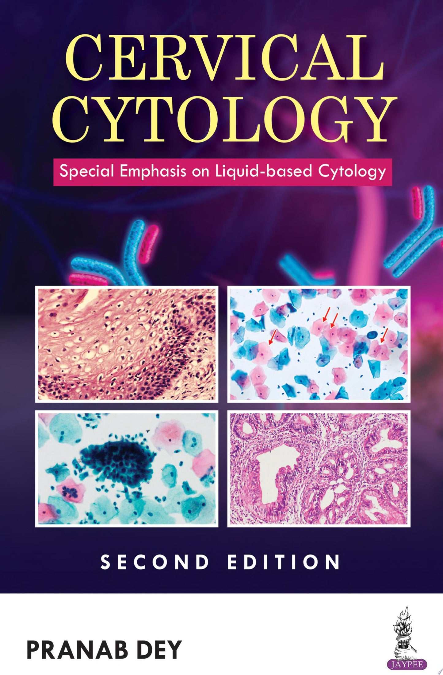 Cervical Cytology: Special Emphasis on Liquid-based Cytology, 2ed