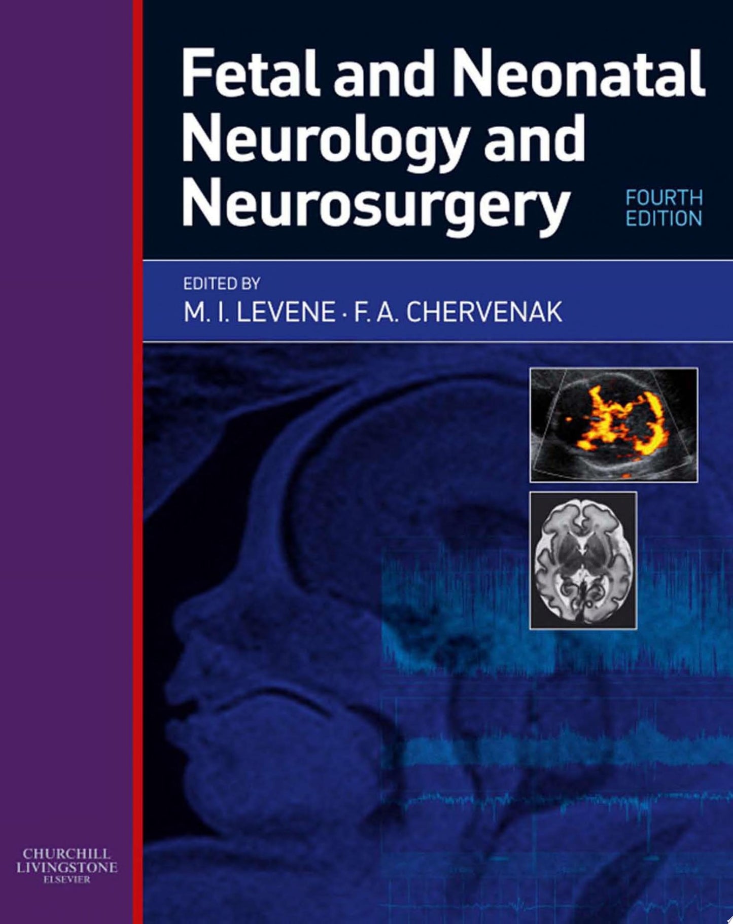 Fetal and Neonatal Neurology and Neurosurgery, 4th Edition