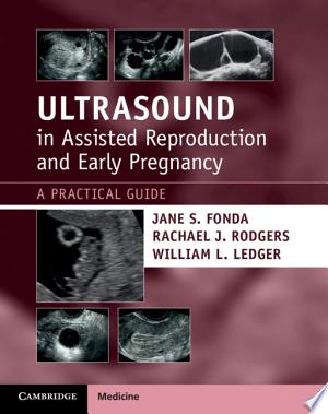 Ultrasound in Assisted Reproduction and Early Pregnancy: A Practical Guide