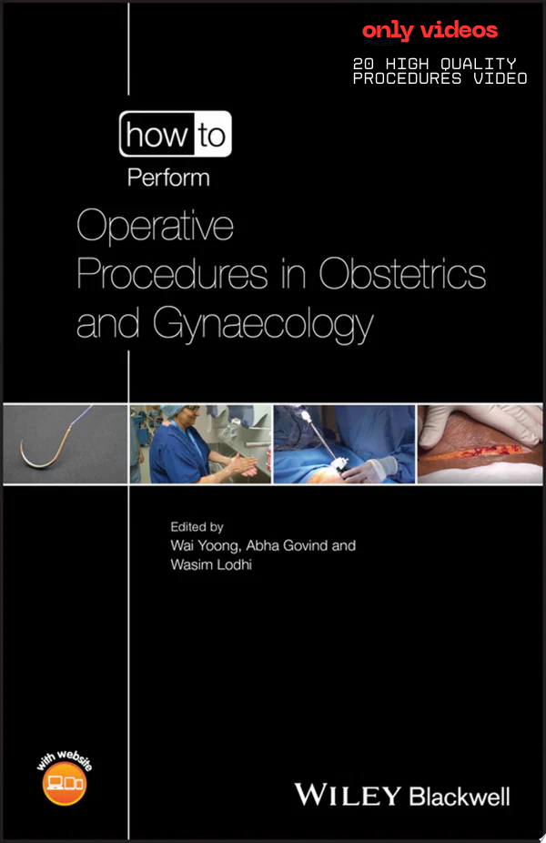 How to Perform Operative Procedures in Obstetrics and Gynaecology (20 High Quality Procedures Video)