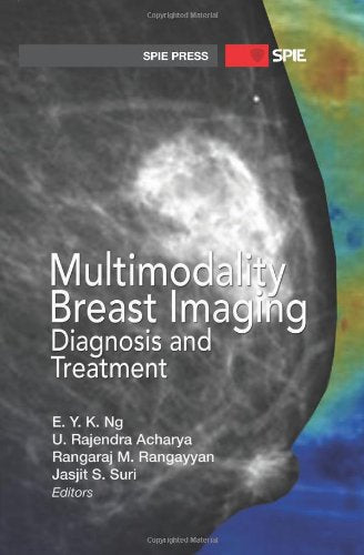 Multimodality Breast Imaging: Diagnosis and Treatment