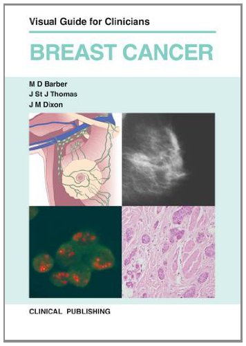 Breast Cancer: Visual Guide for Clinicians