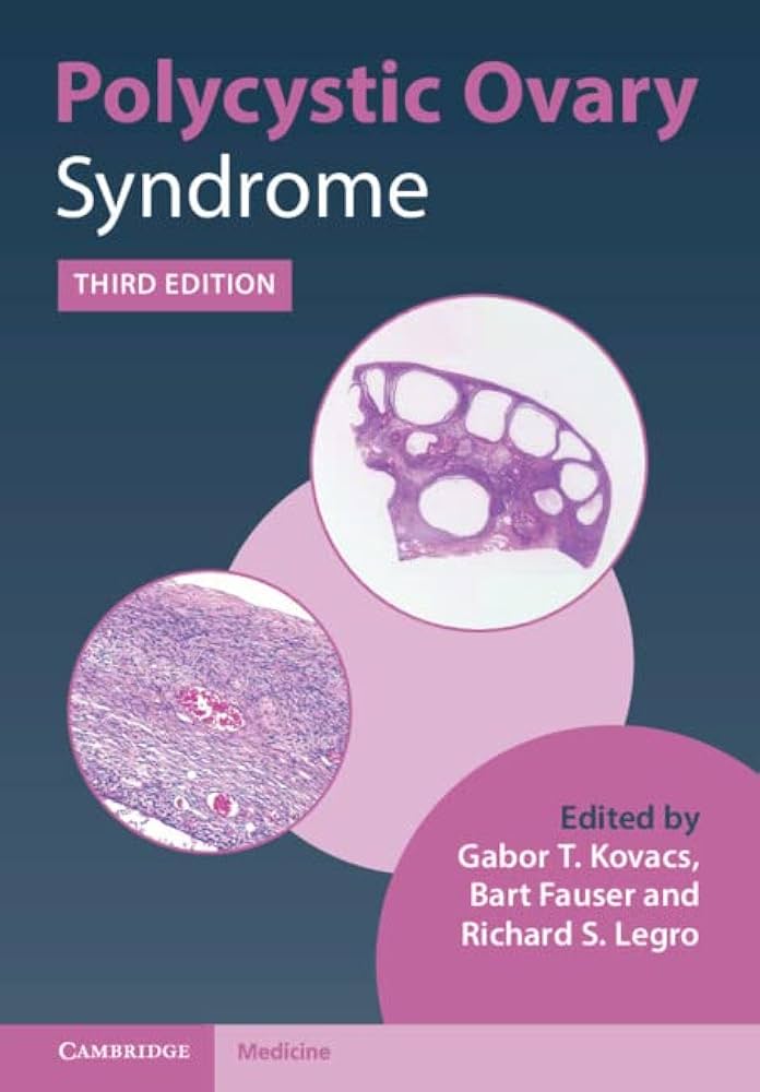 Polycystic Ovary Syndrome, 3rd edition