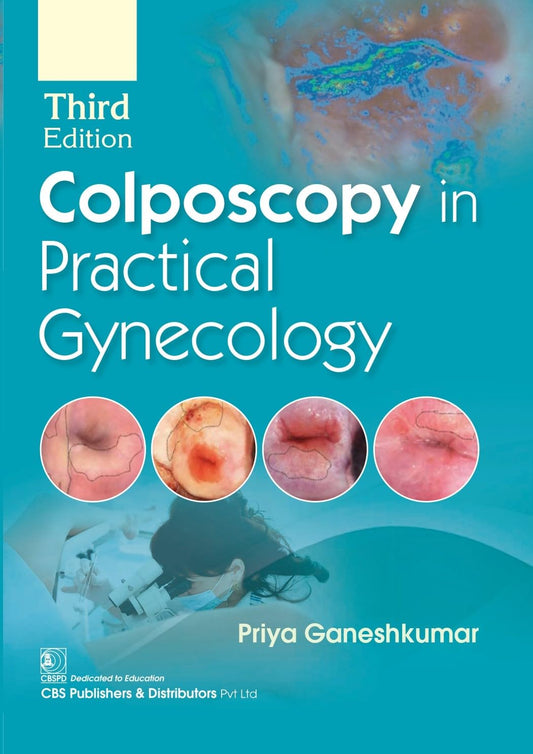 Colposcopy in Practical Gynecology, 3rd Edition -2025