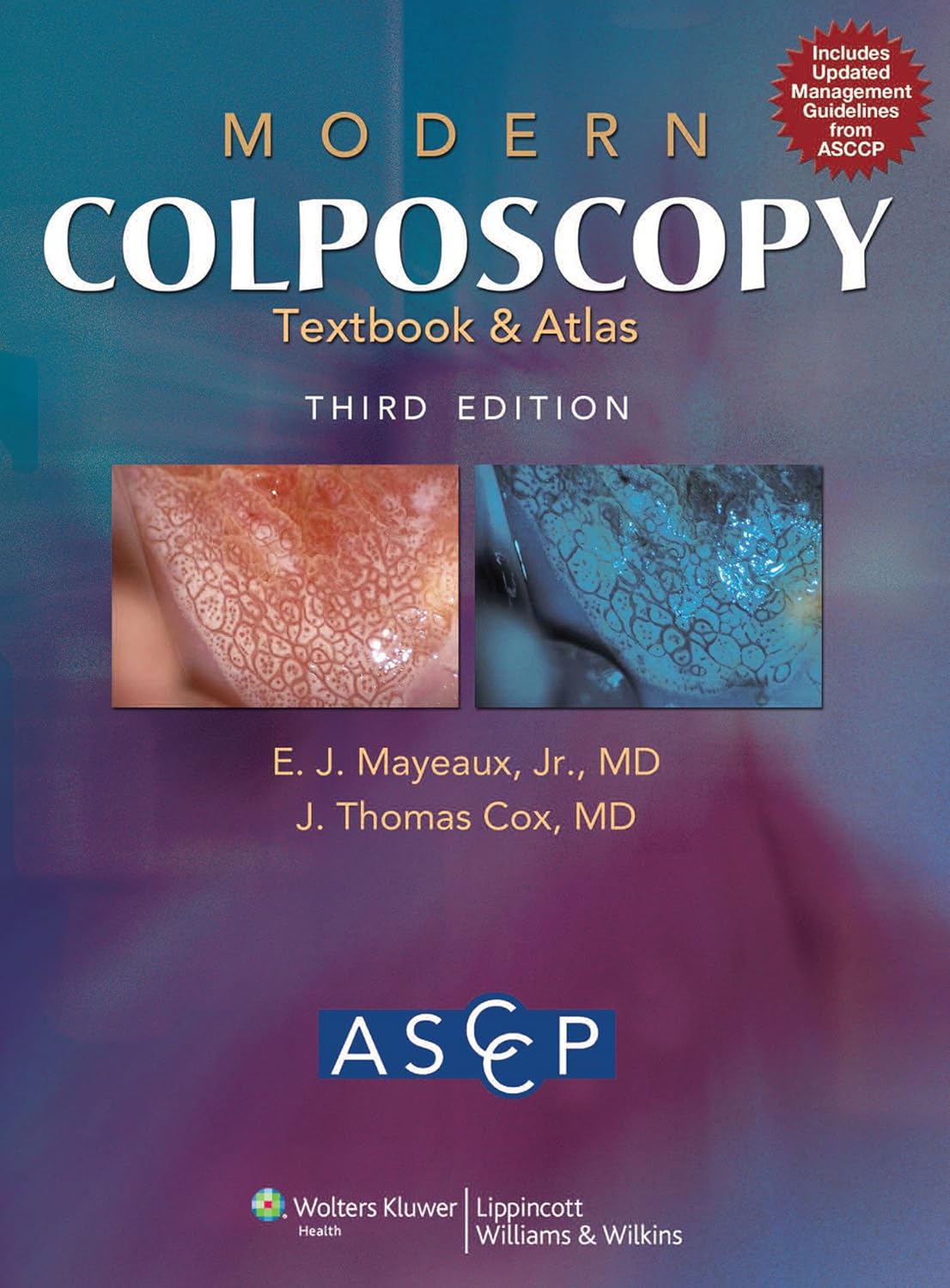 Modern Colposcopy Textbook and Atlas 3rd Edition