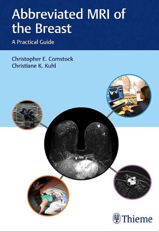 Abbreviated MRI of the Breast: A Practical Guide