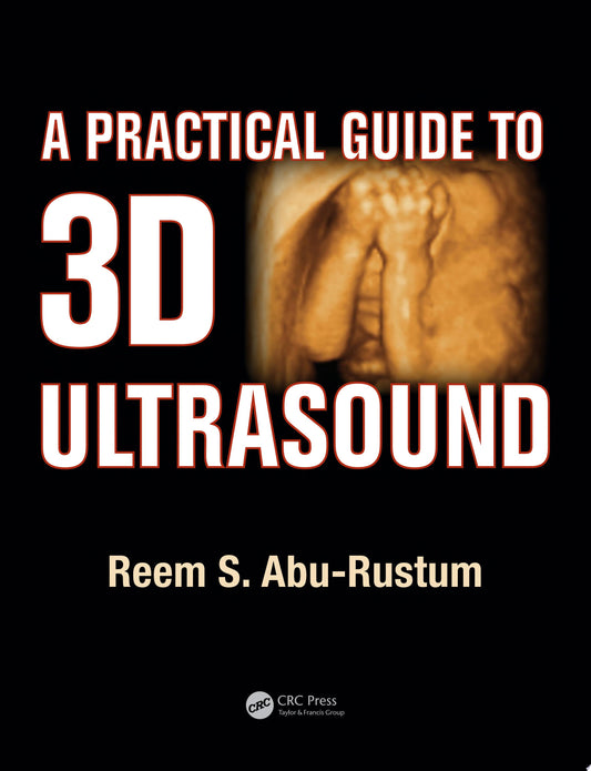 A Practical Guide to 3D Ultrasound
