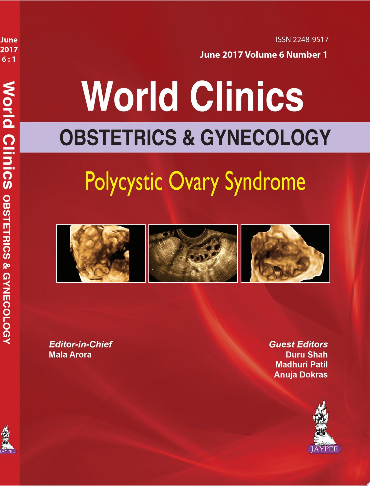 World Clinics: Obstetrics & Gynecology: Polycystic Ovary Syndrome