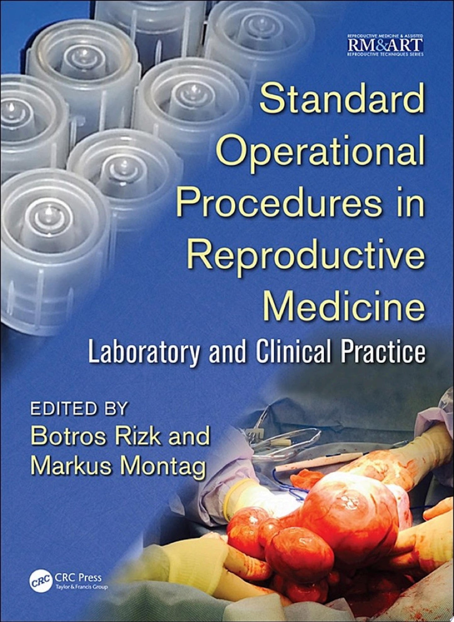 Standard Operational Procedures in Reproductive Medicine: Laboratory and Clinical Practice