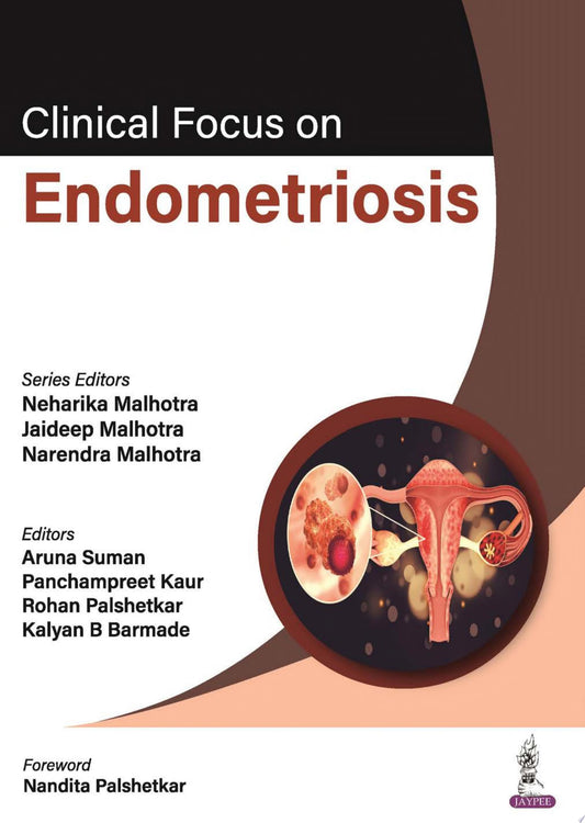 Clinical Focus on Endometriosis