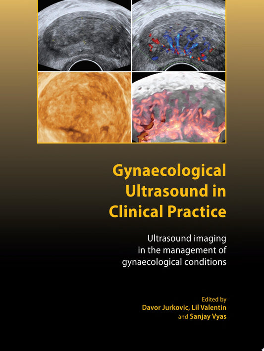 Gynaecological Ultrasound in Clinical Practice: Ultrasound Imaging in the Management of Gynaecological Conditions