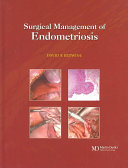 Surgical Management of Endometriosis