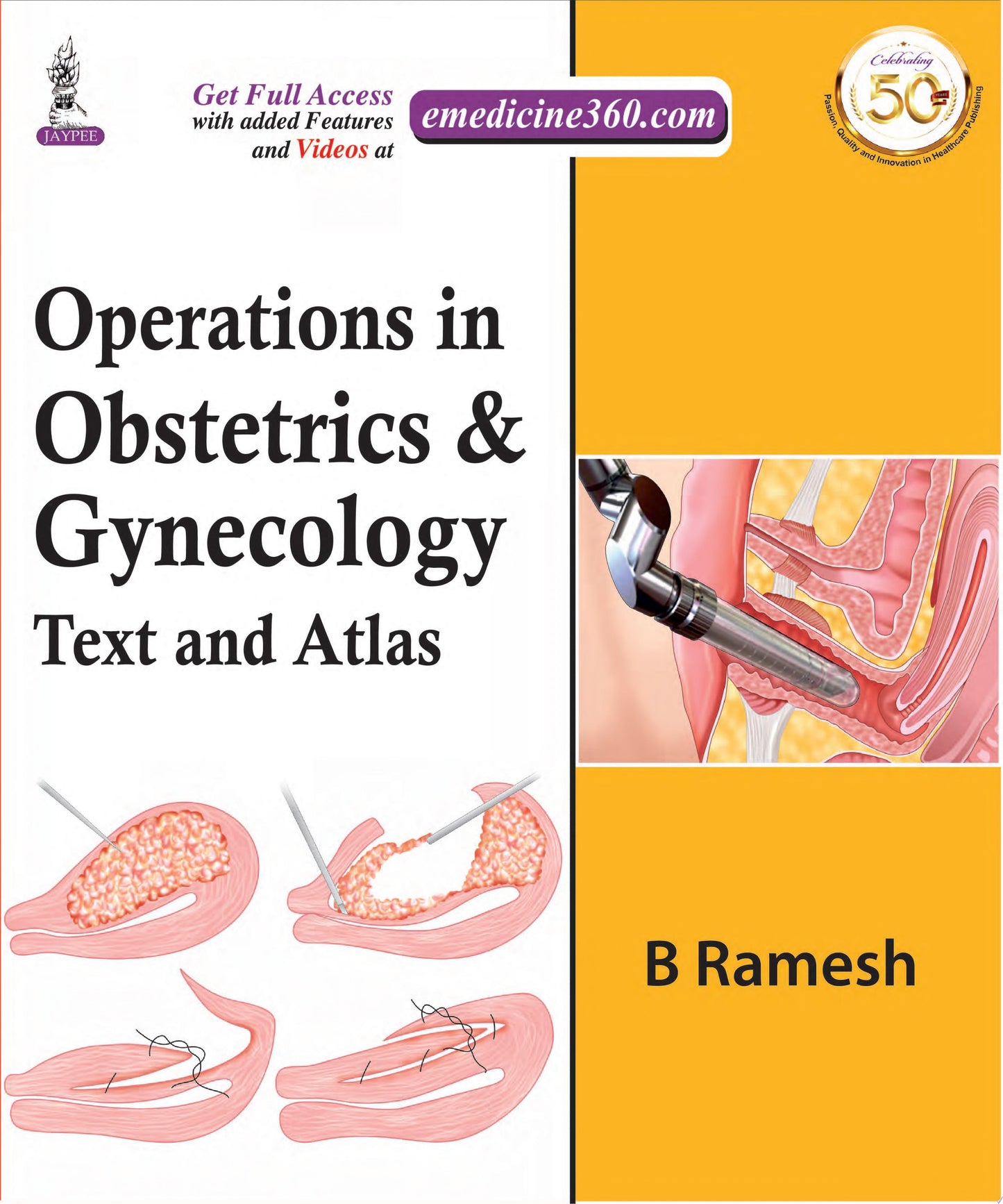 Operations in Obstetrics & Gynecology: Text And Atlas