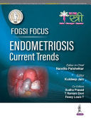 FOGSI Focus Endometriosis Current Trends