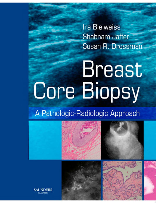 Breast Core Biopsy: A Pathologic-Radiologic Approach