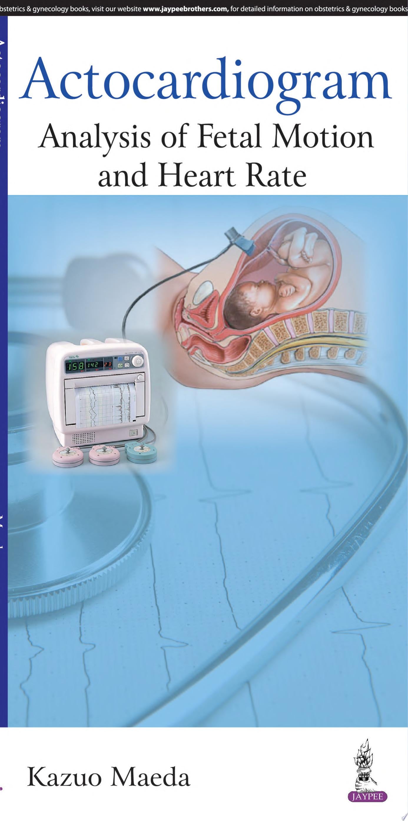 Actocardiogram: Analysis of Fetal Motion and Heart Rate