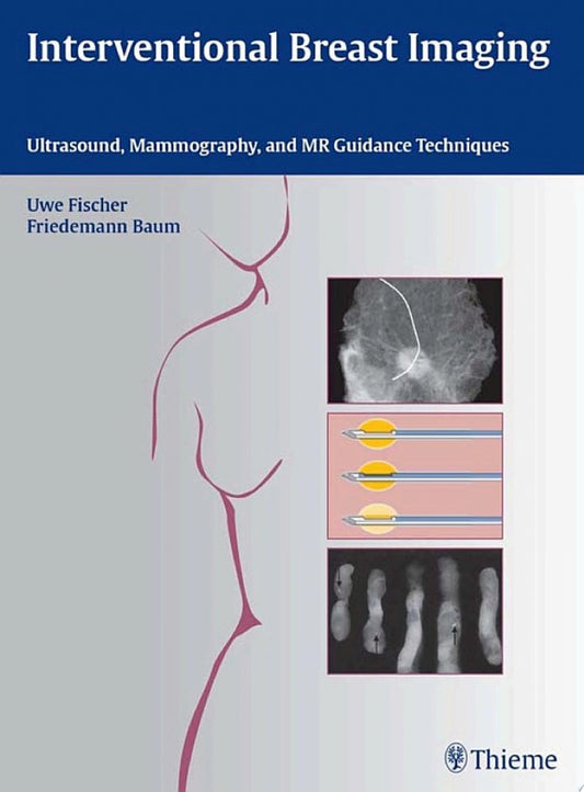 Interventional Breast Imaging: Ultrasound, Mammography, and MR Guidance Techniques