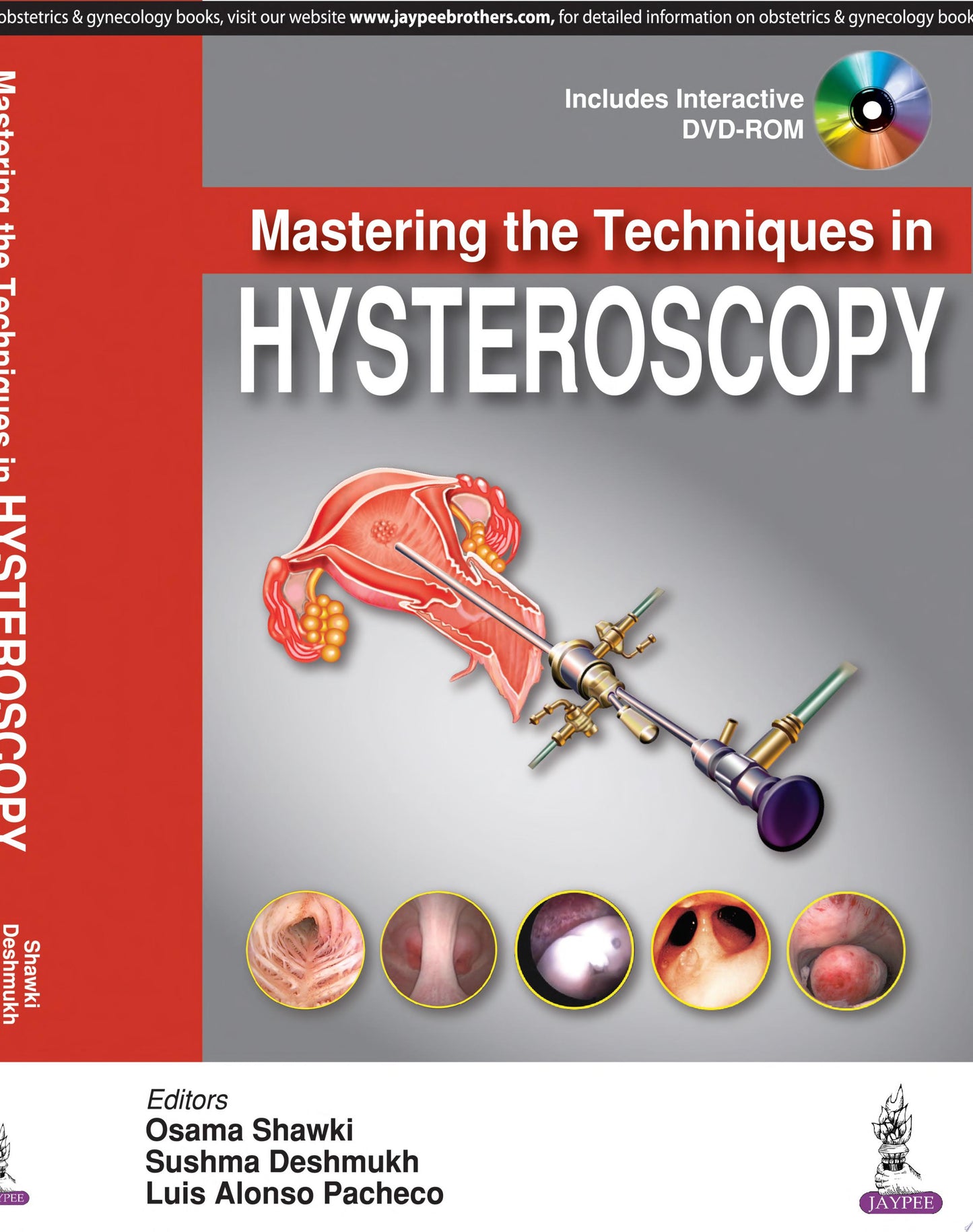 Mastering the Techniques in Hysteroscopy