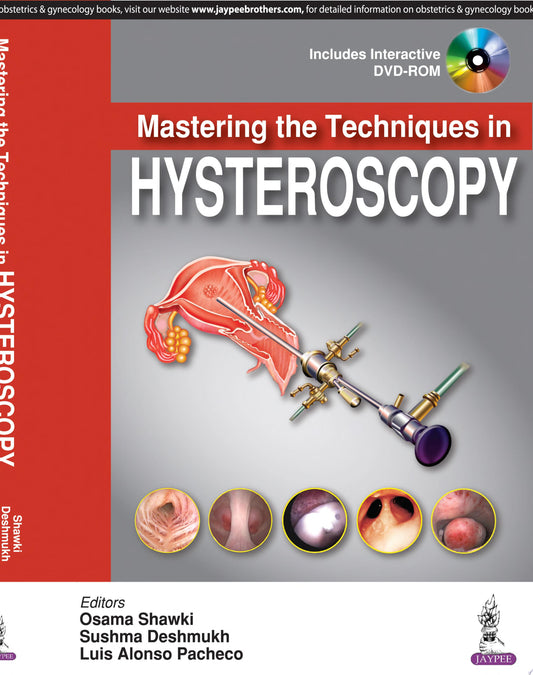 Mastering the Techniques in Hysteroscopy