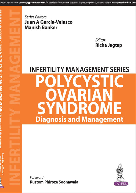 Decoding Polycystic Ovarian Syndrome