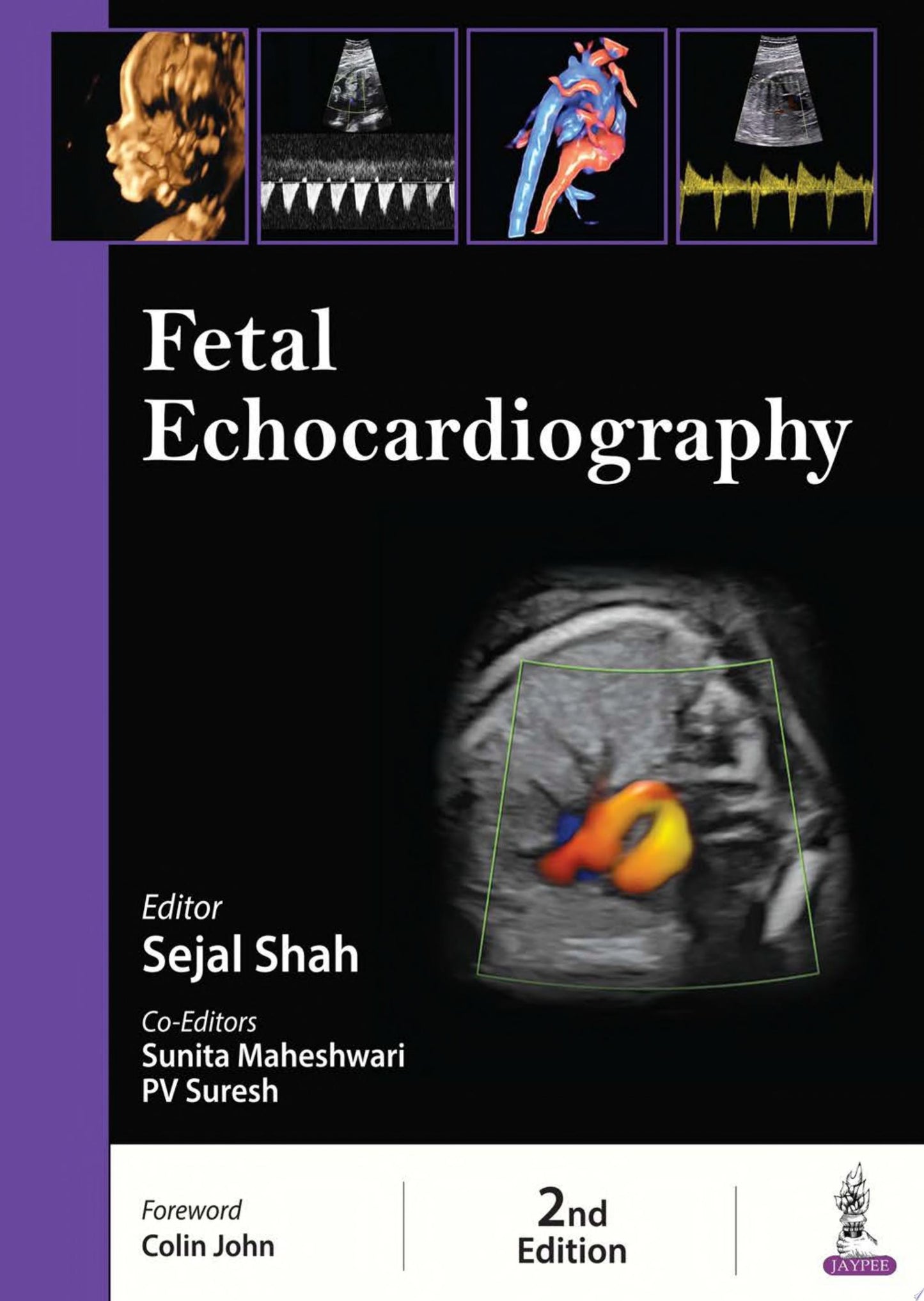 Fetal Echocardiography, 2nd edition