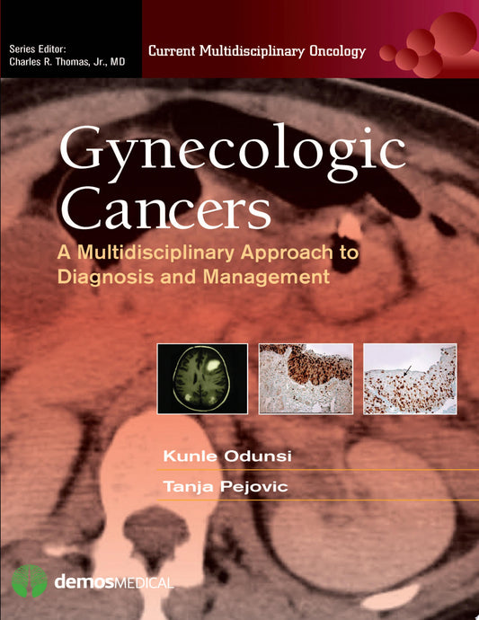 Gynecologic Cancers: A Multidisciplinary Approach to Diagnosis and Management
