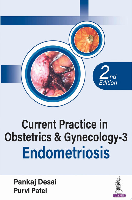 Current Practice in Obstetrics & Gynecology – 3: Endometriosis