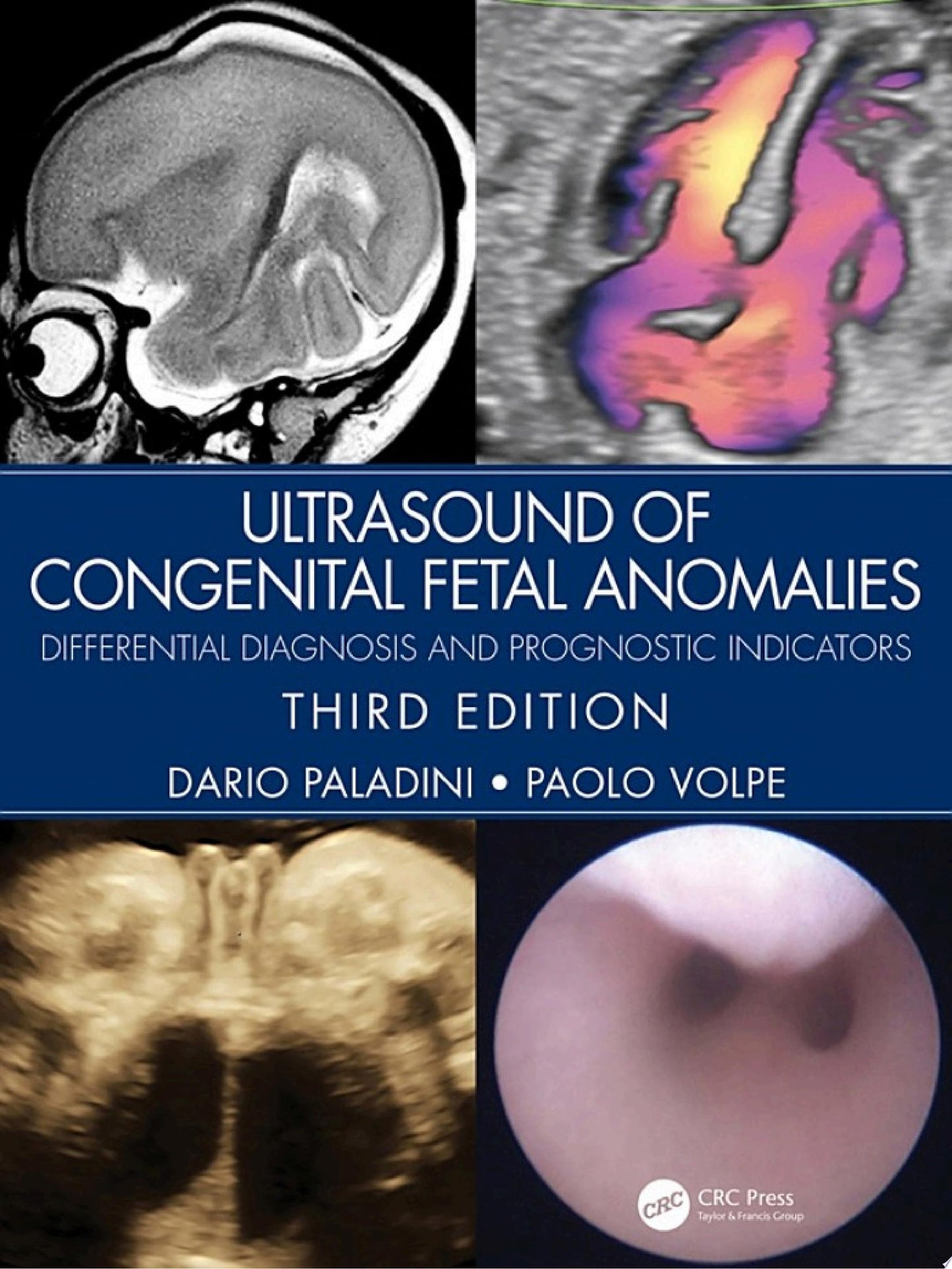 Ultrasound of Congenital Fetal Anomalies: Differential Diagnosis and Prognostic Indicators, 3rd edition