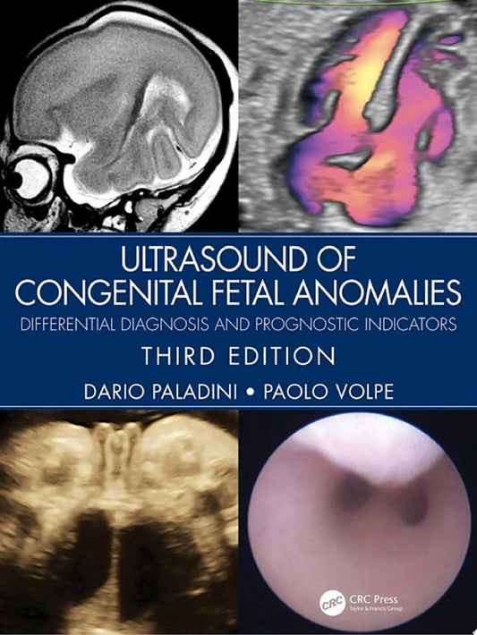 Ultrasound of Congenital Fetal Anomalies: Differential Diagnosis and Prognostic Indicators, 3rd edition