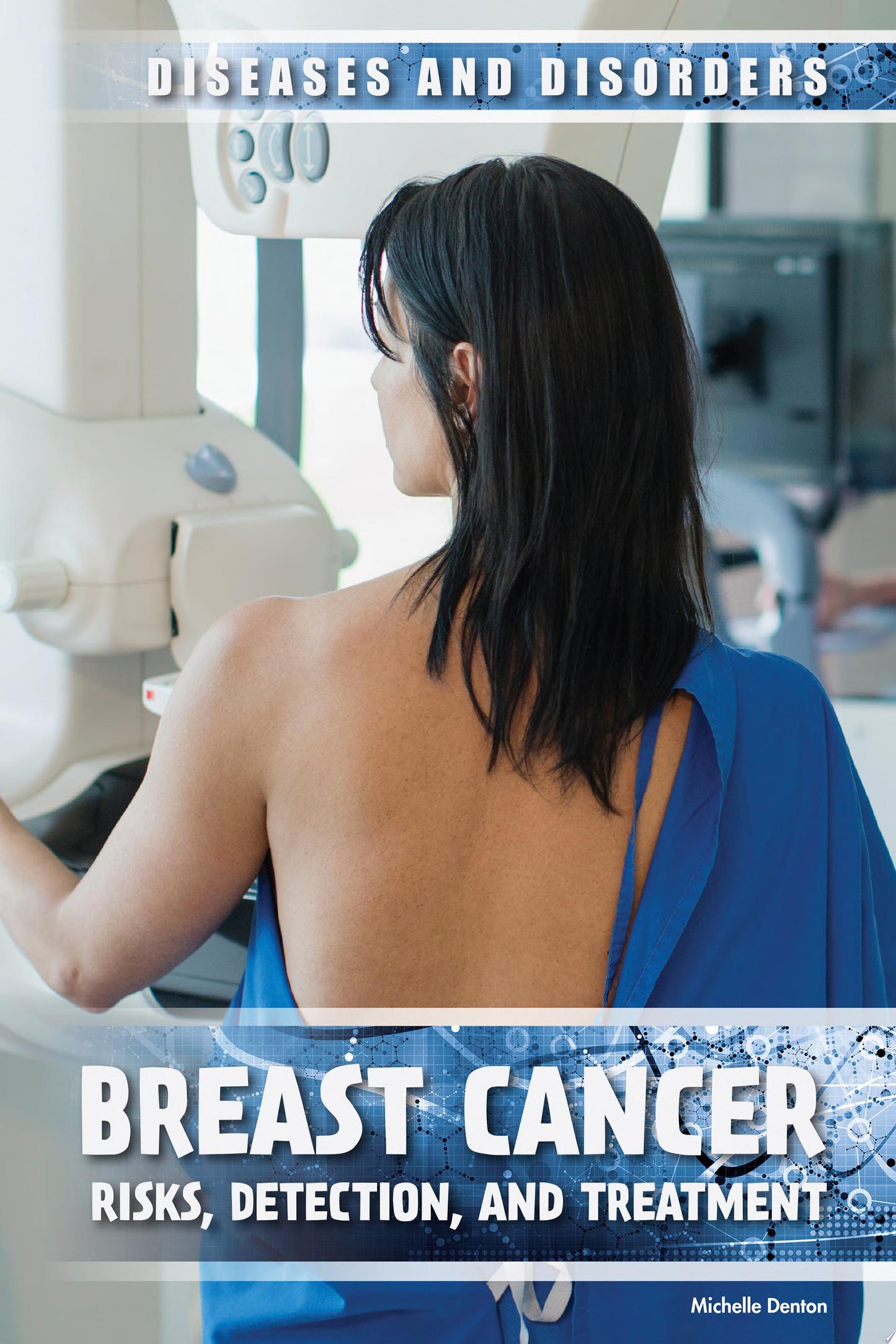 Breast Cancer: Risks, Detection, and Treatment