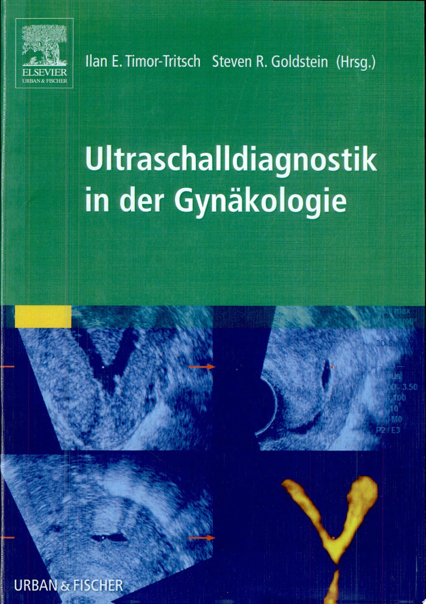 Differential Diagnosis in Obstetric and Gynecologic Ultrasound 3rd