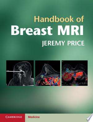 Handbook of Breast MRI