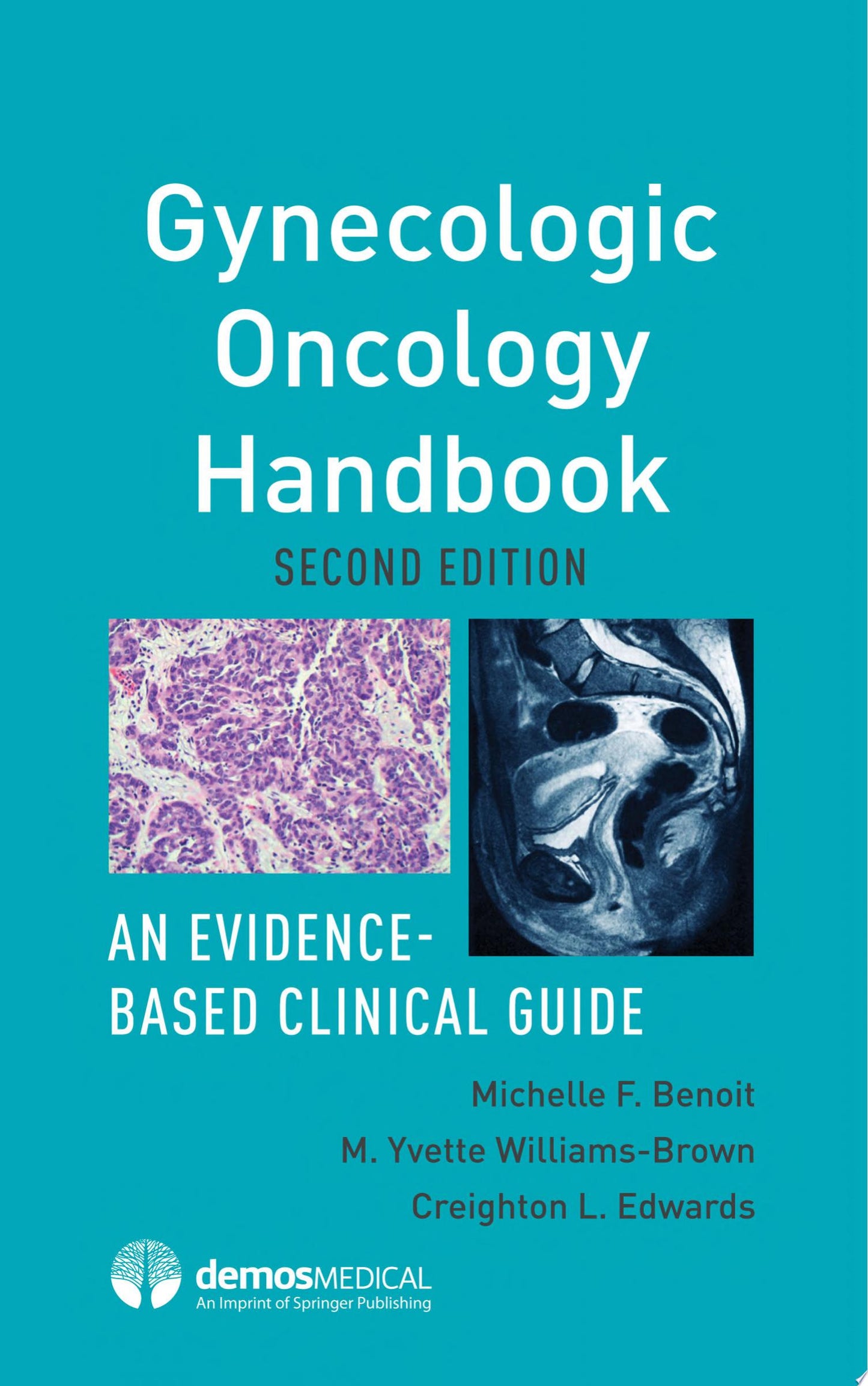 Gynecologic Oncology Handbook: An Evidence-Based Clinical Guide, 2nd Edition