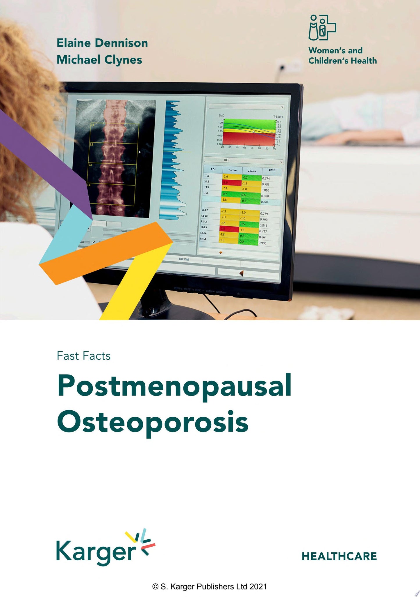 Fast Facts: Postmenopausal Osteoporosis