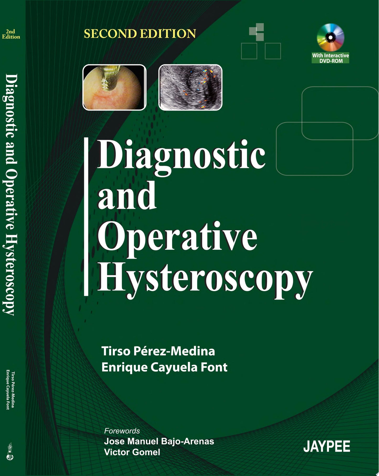 Diagnostic and Operative Hysteroscopy